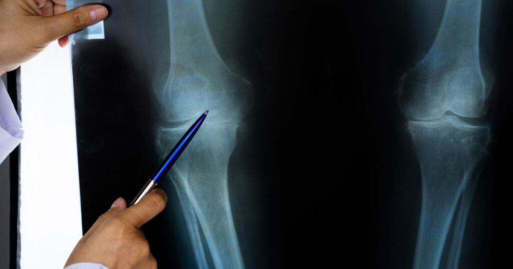 médico explica radiografía