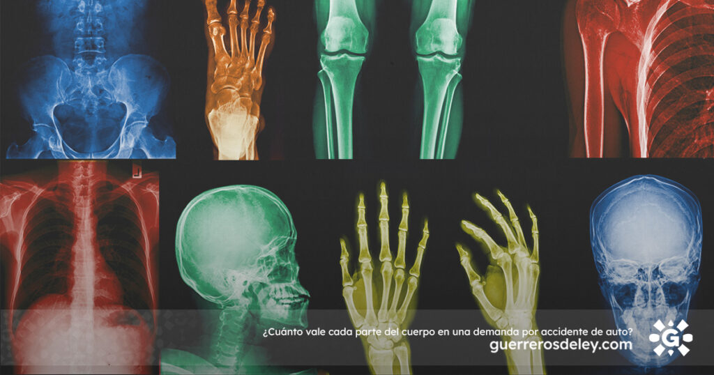 radiografías de cuerpo humano